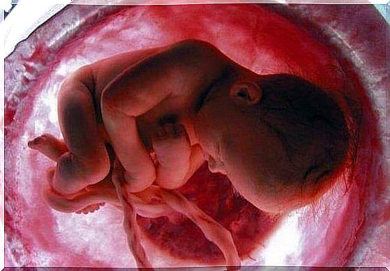 Umbilical cord wrapped around the fetus during pregnancy and childbirth