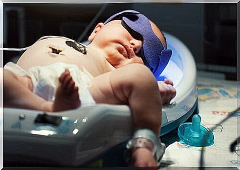 What causes newborn jaundice?