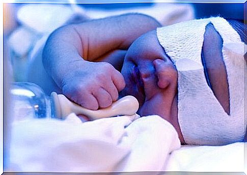 Jaundice in a healthy newborn